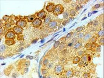 Anti-BOLL antibody, C-term used in IHC (Paraffin sections) (IHC-P). GTX89597