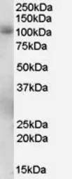 Anti-PDE5A antibody, C-term used in Western Blot (WB). GTX89598