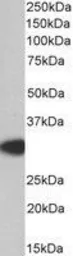 Anti-MyD88 antibody, Internal used in Western Blot (WB). GTX89605