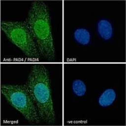 Anti-PAD4 antibody, N-term used in Immunocytochemistry/ Immunofluorescence (ICC/IF). GTX89631