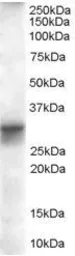 Anti-FHL1 isoform B antibody, Internal used in Western Blot (WB). GTX89636