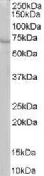 Anti-RIC8A antibody, C-term used in Western Blot (WB). GTX89648