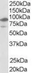 Anti-LXR beta antibody, N-term used in Western Blot (WB). GTX89661