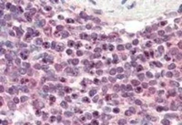 Anti-LXR beta antibody, N-term used in IHC (Paraffin sections) (IHC-P). GTX89661