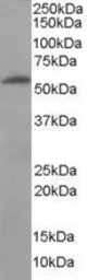 Anti-58K Golgi protein antibody, Internal used in Western Blot (WB). GTX89671