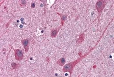 Anti-STAP2 antibody, C-term used in IHC (Paraffin sections) (IHC-P). GTX89679