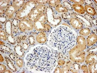 Anti-WHIP antibody, C-term used in IHC (Paraffin sections) (IHC-P). GTX89707