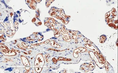 Anti-PI3 kinase C2 alpha antibody, C-term used in IHC (Paraffin sections) (IHC-P). GTX89716