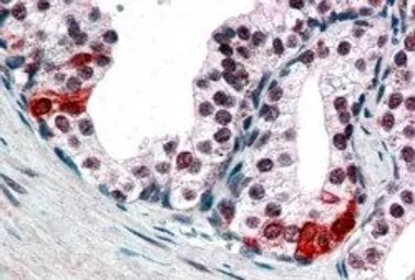 Anti-BAF57 antibody, C-term used in IHC (Paraffin sections) (IHC-P). GTX89755