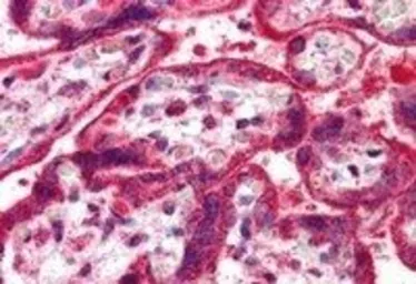 Anti-NEIL1 antibody, C-term used in IHC (Paraffin sections) (IHC-P). GTX89756