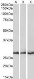 Anti-CAPZB antibody, C-term used in Western Blot (WB). GTX89785