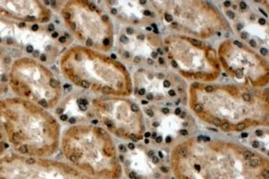 Anti-RNF34 antibody, N-term used in IHC (Paraffin sections) (IHC-P). GTX89815