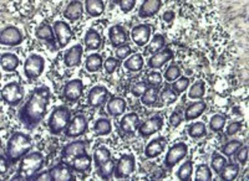 Anti-NLRP3 ( C Terminus) antibody, C-term used in IHC (Paraffin sections) (IHC-P). GTX89829