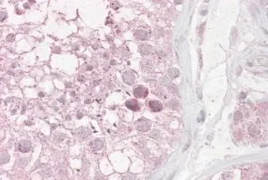 Anti-RNF36 antibody, C-term used in IHC (Paraffin sections) (IHC-P). GTX89832