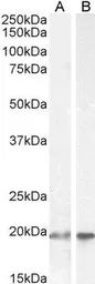 Anti-UBE2C antibody, C-term used in Western Blot (WB). GTX89866
