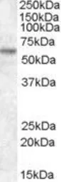 Anti-TFE3 antibody, N-term used in Western Blot (WB). GTX89882