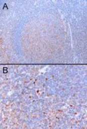 Anti-GATA3 antibody, N-term used in IHC (Paraffin sections) (IHC-P). GTX89886