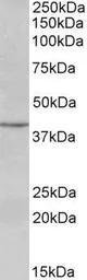 Anti-PAX5 antibody, N-term used in Western Blot (WB). GTX89903