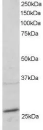 Anti-Rab11A antibody, C-term used in Western Blot (WB). GTX89906