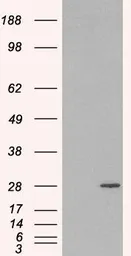 Anti-Rab11A antibody, C-term used in Western Blot (WB). GTX89906