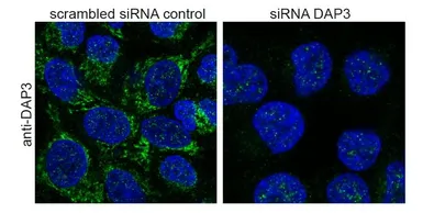 Anti-DAP3 antibody, C-term used in Immunocytochemistry/ Immunofluorescence (ICC/IF). GTX89921