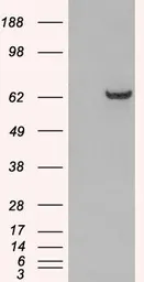 Anti-GRB7 antibody, N-term used in Western Blot (WB). GTX89926