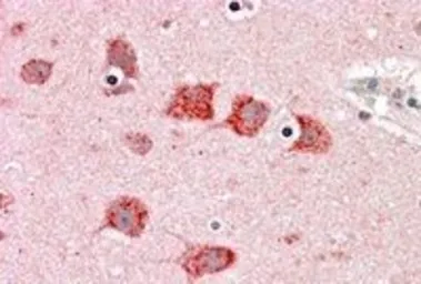 Anti-DKK3 antibody, C-term used in IHC (Paraffin sections) (IHC-P). GTX89935
