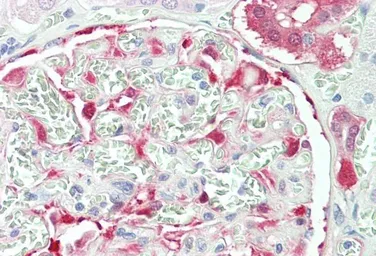 Anti-NQO1 antibody, C-term used in IHC (Paraffin sections) (IHC-P). GTX89937