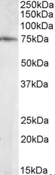Anti-ELMO3 antibody, C-term used in Western Blot (WB). GTX89943