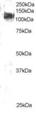 Anti-CBL antibody, C-term used in Western Blot (WB). GTX89954