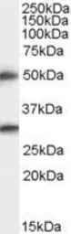 Anti-Spinesin antibody, C-term used in Western Blot (WB). GTX89957
