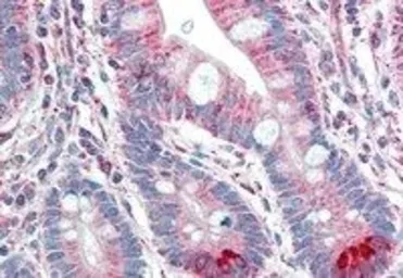Anti-Spinesin antibody, C-term used in IHC (Paraffin sections) (IHC-P). GTX89957