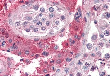 Anti-SET antibody, N-term used in IHC (Paraffin sections) (IHC-P). GTX89960