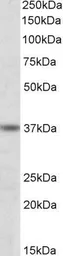 Anti-ATF4 antibody, C-term used in Western Blot (WB). GTX89973