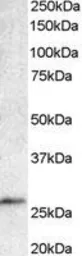 Anti-BCL7A antibody, C-term used in Western Blot (WB). GTX89978