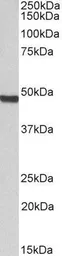 Anti-ORC4L antibody, C-term used in Western Blot (WB). GTX89991