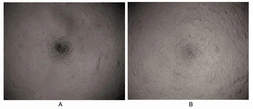 Human LMTK3 protein, His and SUMO tag (active). GTX00071-pro