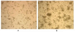 Human GM-CSF protein, His tag (active). GTX00082-pro