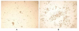 Human IL15 protein, His tag (active). GTX00088-pro