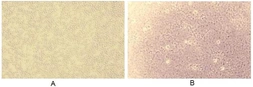 Human Factor B (Ba fragment) protein, His and GST tag (active). GTX00269-pro