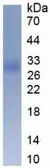 Human SOD3 protein, His tag. GTX00276-pro