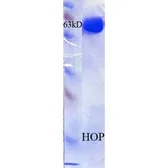 Human STIP1 protein, His tag (active). GTX00445-pro