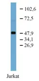 Anti-TFG antibody [TFG-03] used in Western Blot (WB). GTX00523
