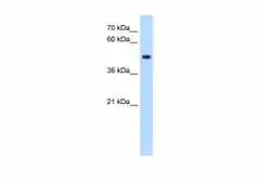 Anti-STYK1 antibody used in Western Blot (WB). GTX00635