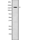 Anti-Nup153 antibody used in Western Blot (WB). GTX00649