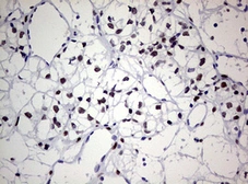 Anti-ZEB2 antibody [OTI1E12] used in IHC (Paraffin sections) (IHC-P). GTX00672