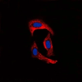 Anti-MMP1 antibody used in Immunocytochemistry/ Immunofluorescence (ICC/IF). GTX00674