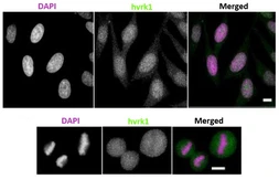 Anti-VRK1 antibody [5D1] used in Immunocytochemistry/ Immunofluorescence (ICC/IF). GTX00703