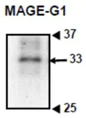 Anti-MAGEG1 antibody used in Western Blot (WB). GTX00755