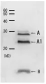 Anti-Cholera toxin antibody used in Western Blot (WB). GTX00756